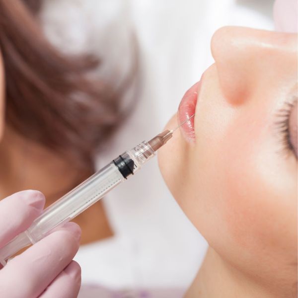 Zonas m&aacute;s comunes donde se utiliza este relleno de &aacute;cido hiarul&oacute;nico